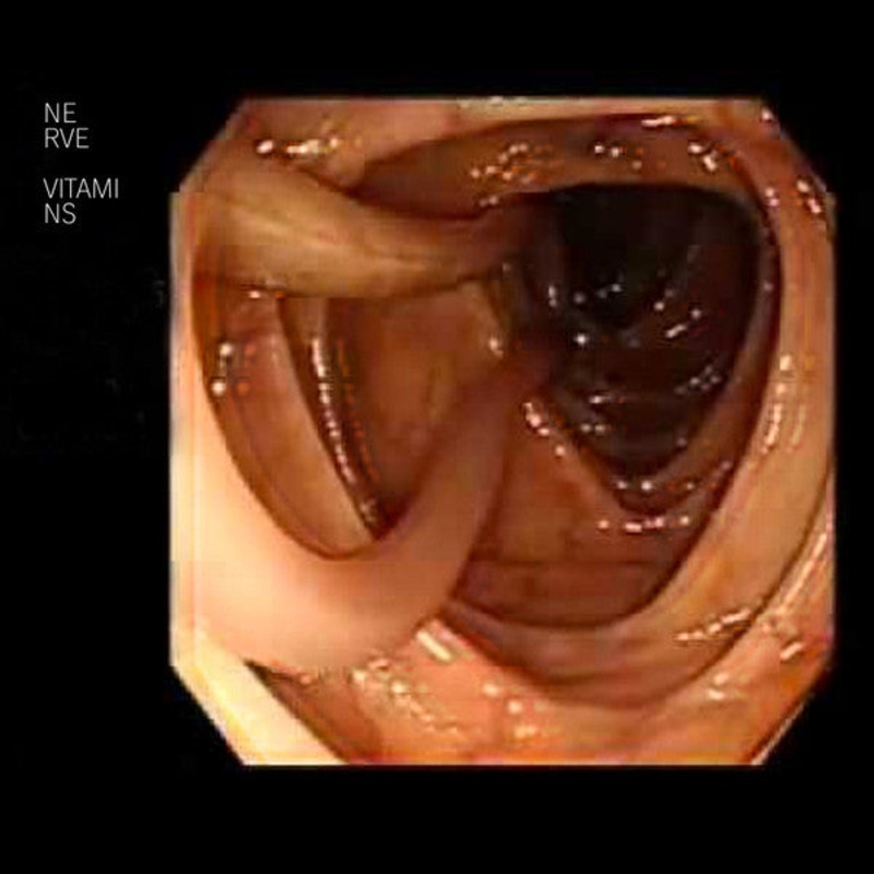 Nerve Vitamins  Good Colonoscopy Cassette